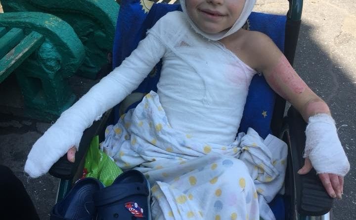 Стала известна судьба одесского ребенка, пострадавшего от взрыва газа в авто