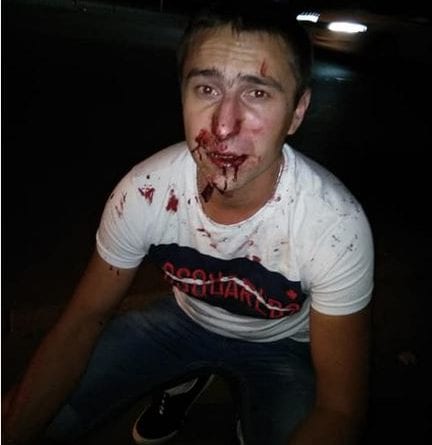 В Одессе избит таксист: нападавший объяснил за что