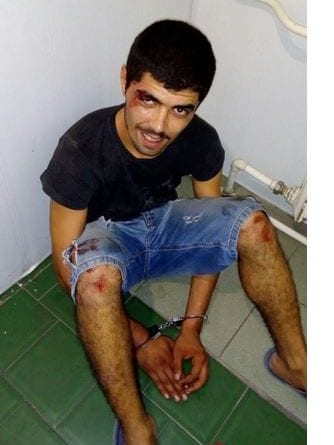 В Одессе житель Азербайджана бросался с ножом на прохожих
