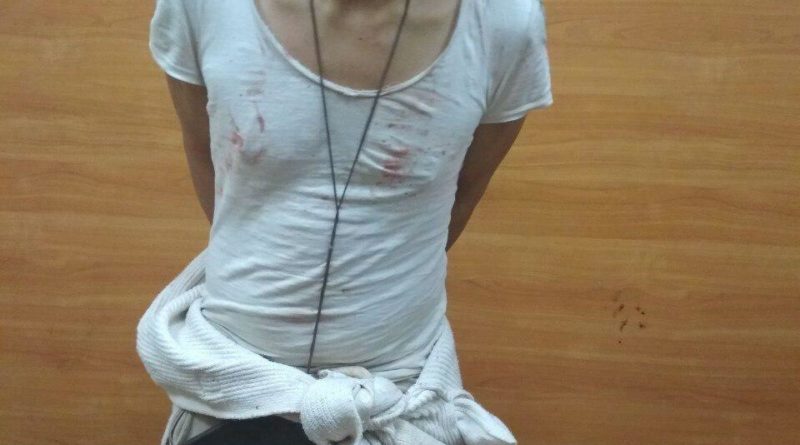 В Одессе задержали иностранца, избившего свою сожительницу гантелей