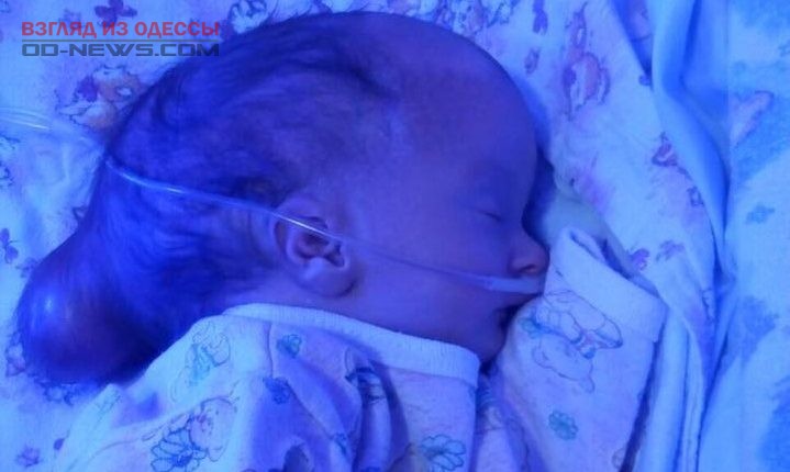 В Одессе срочно нужна помощь новорожденной малышке