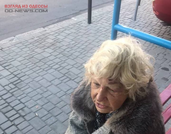 В Одессе обнаружена пенсионерка в синяках и ссадинах