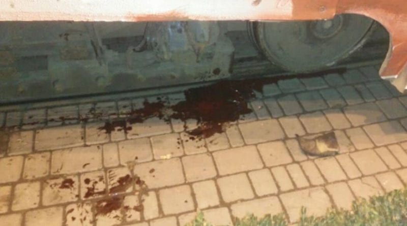 В Одессе мужчина лишился конечности, угодив под трамвай