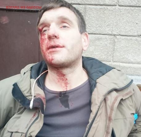 В центре Одессы избили неизвестного парня