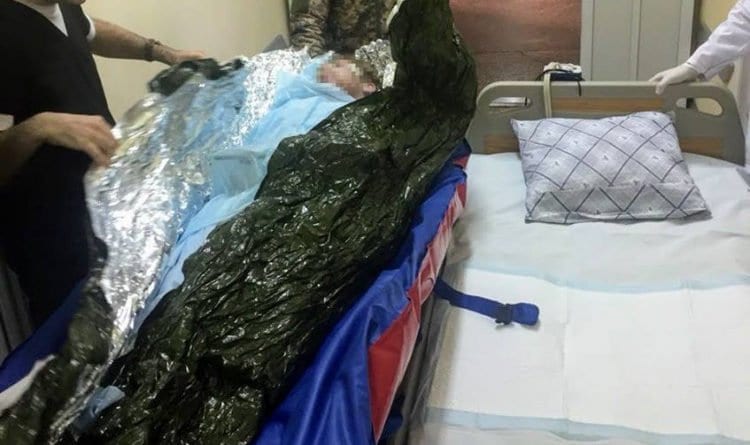 В госпиталь Одессы доставлен тяжелораненый воин