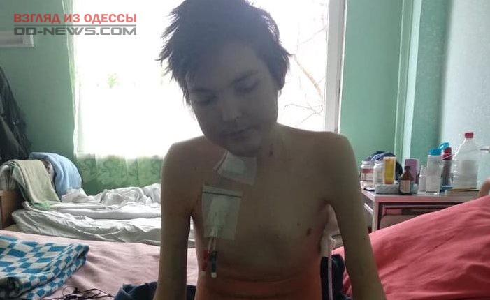 Волонтеры в Одессе помогли парню с тяжелейшим заболеванием