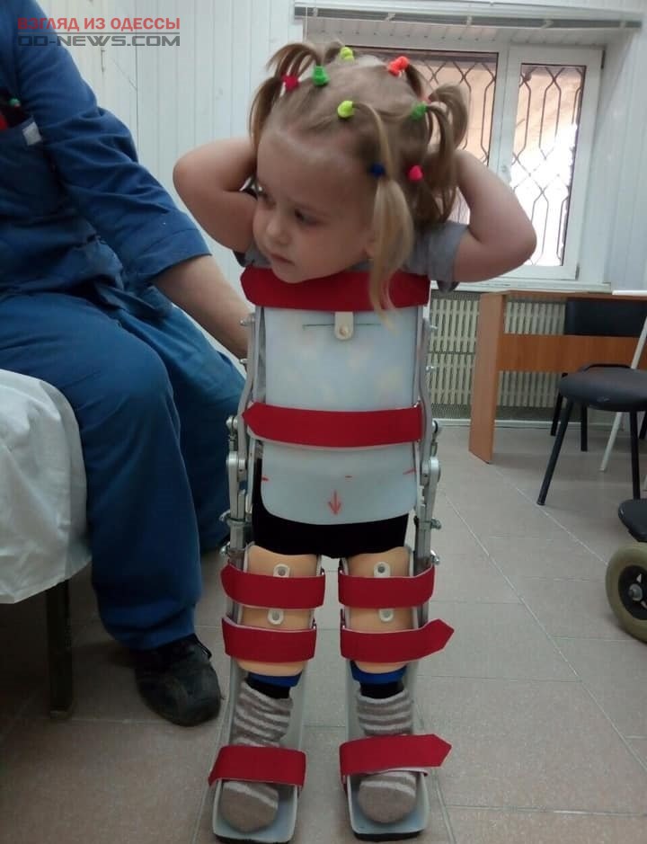 В Одессе волонтеры помогают девочке, не умеющей ходить