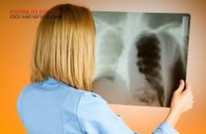 В Одессе медсестер, обслуживающих больных туберкулезом, ждут доплаты