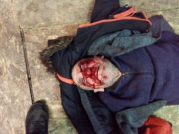 В Одессе возле пункта обогрева бездомных нашли окровавленного мужчину